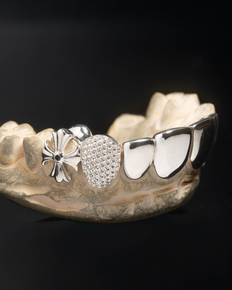 Custom grillz